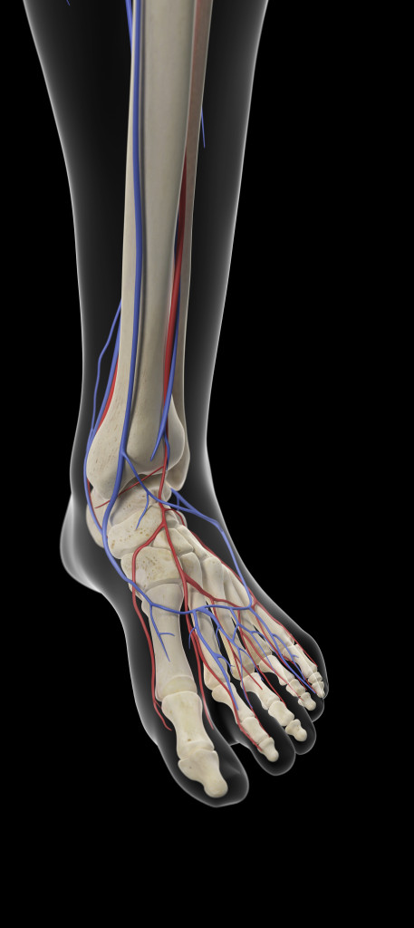 Peripheral Vascular Disease (Leg Pain) - The Johns Hopkins Patient
