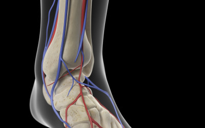 Peripheral Vascular Disease (Leg Pain)