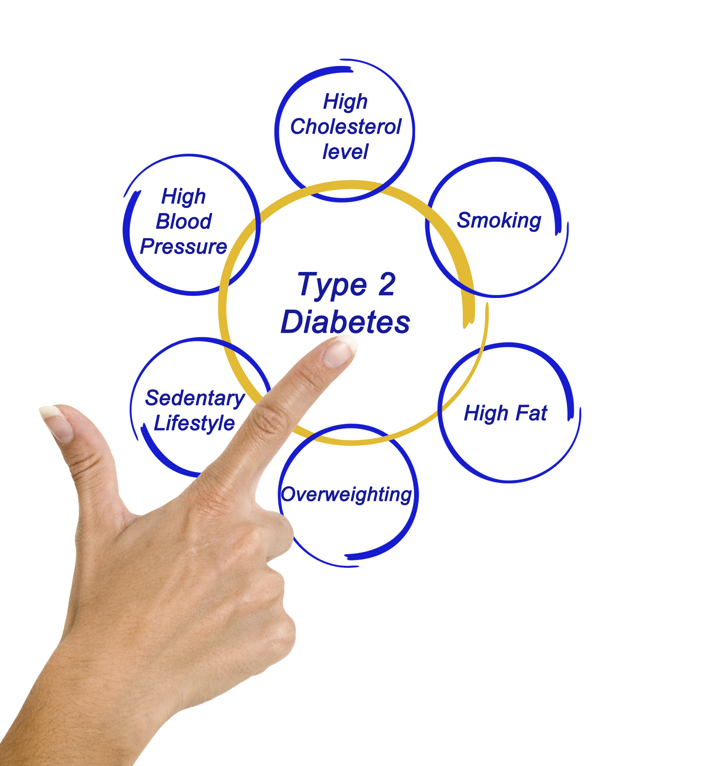 Genetic And Environmental Risk Factors For Type 2 Diabetes The Johns Hopkins Patient Guide To 