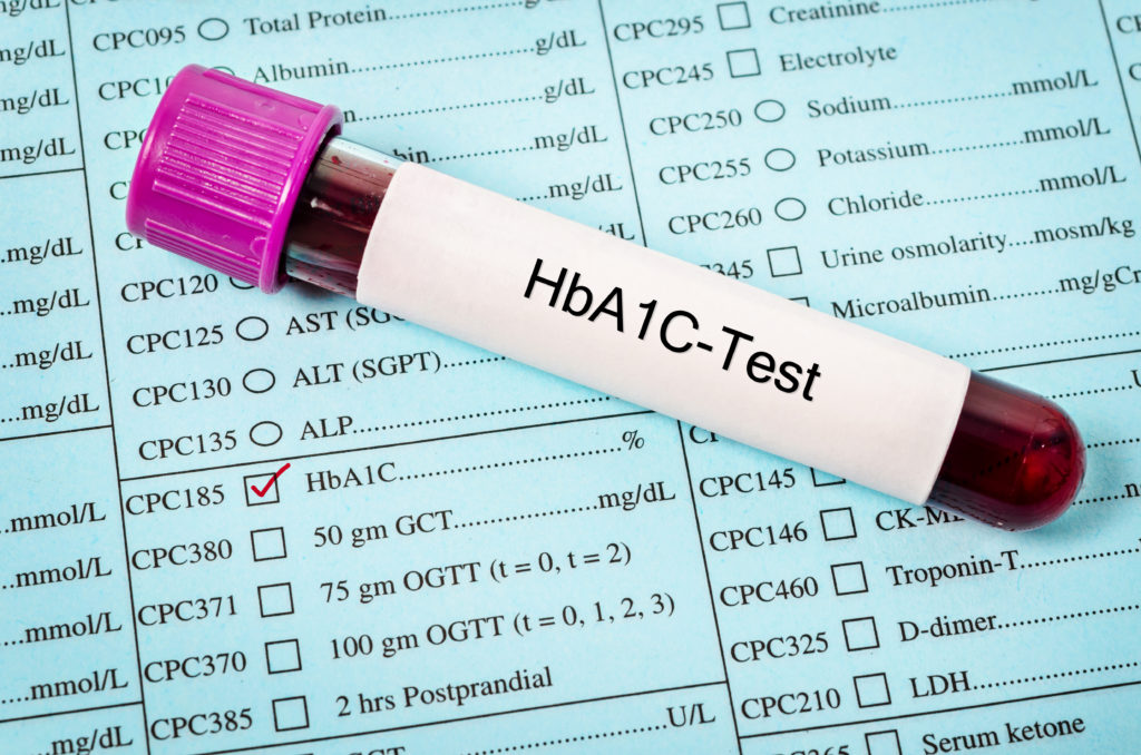 Hemoglobin A1c test The Johns Hopkins Patient Guide to Diabetes