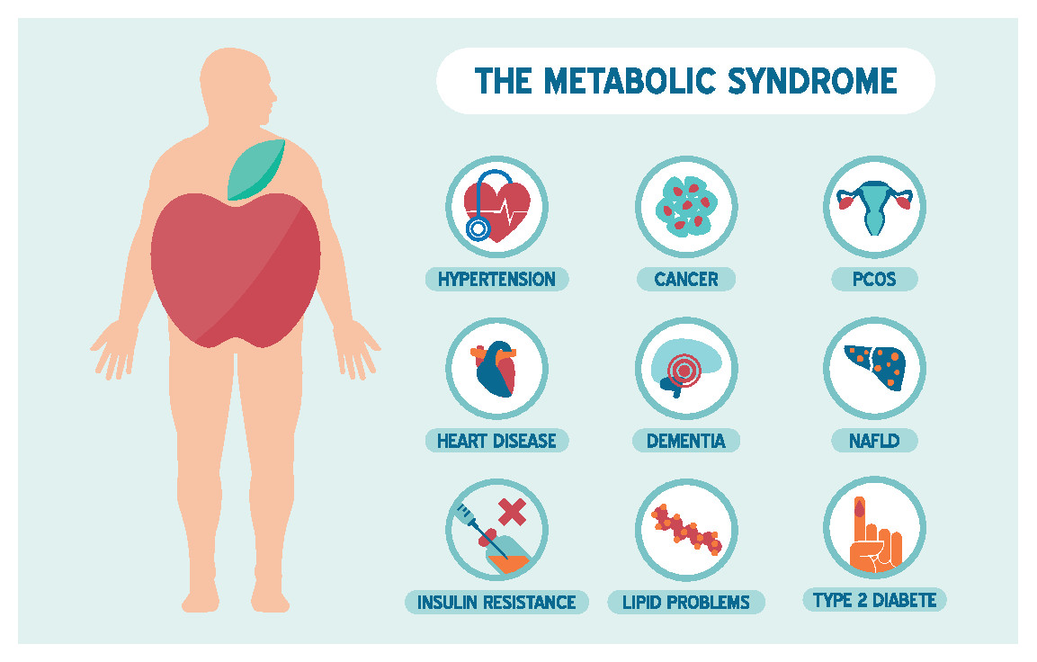 Metabolic Syndrome The Johns Hopkins Patient Guide To Diabetes   Metabolic Syndrome 303216947 